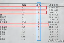 白血病预后好不好，病理报告早就告诉你了，特别是这5点！图片