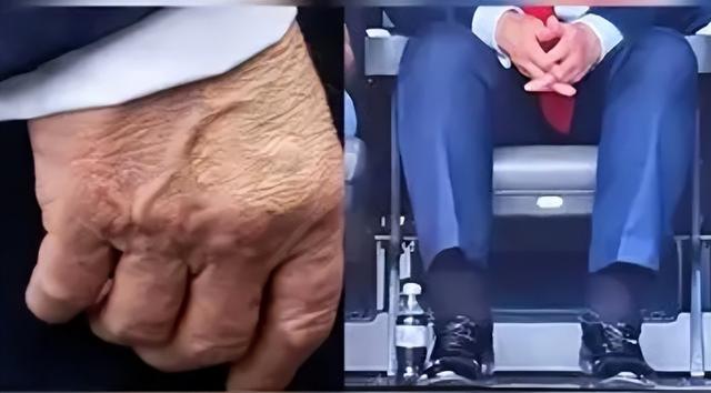 局势失控？拜登被曝患癌才过两月，79岁特朗普身体也出毛病，白宫医生的检查报告遭质疑，美多地趁势揭竿而起