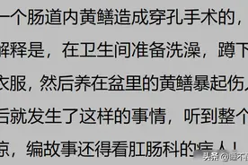 肛肠科医生究竟有多难？网友：从里边拿出来的时候差点被咬到图片