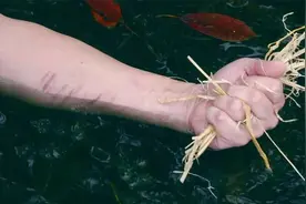 倾家荡产也不能治愈？提醒：这8种病根本无法根治，别花冤枉钱图片