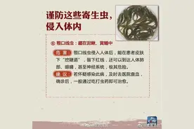 慎吃！深圳一男子肚子里发现“虫卵”、“死虫”！或因爱吃它图片