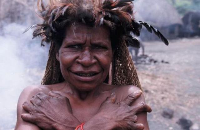 世界上最残忍部落：当亲人去世，关系最亲的女性必须断掉一根手指