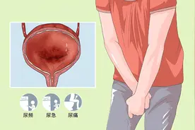 反复尿路感染困扰？揭秘背后的原因与解决方案！图片