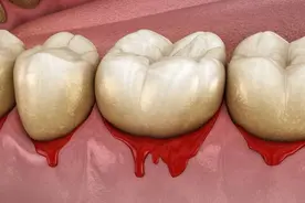 把“炎症”吃回去，这4种蔬菜，或能帮身体抗炎，有你喜欢吃的吗图片