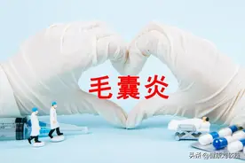 居家治疗毛囊炎，推荐两种外用药膏，好用不贵图片