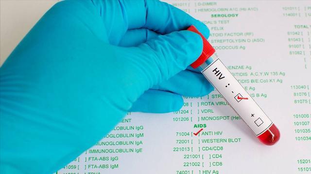 中美俄艾滋病人数差距断崖，俄119万，美国120万，中国令人意外