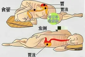 一张图告诉你，左侧卧位和右侧卧位的区别！图片
