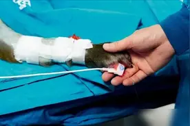 全球首例移植猪的心脏的人，后来他怎么样了？为何是猪不是猴子？图片