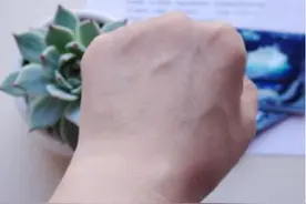 手背血管能看出寿命长短？医生：血管若有这些特征，恭喜你很健康图片