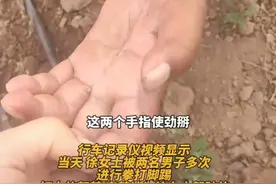 见义勇为被砍手筋成残疾，嫌疑人判三年半，当事人：花八万赔4万图片