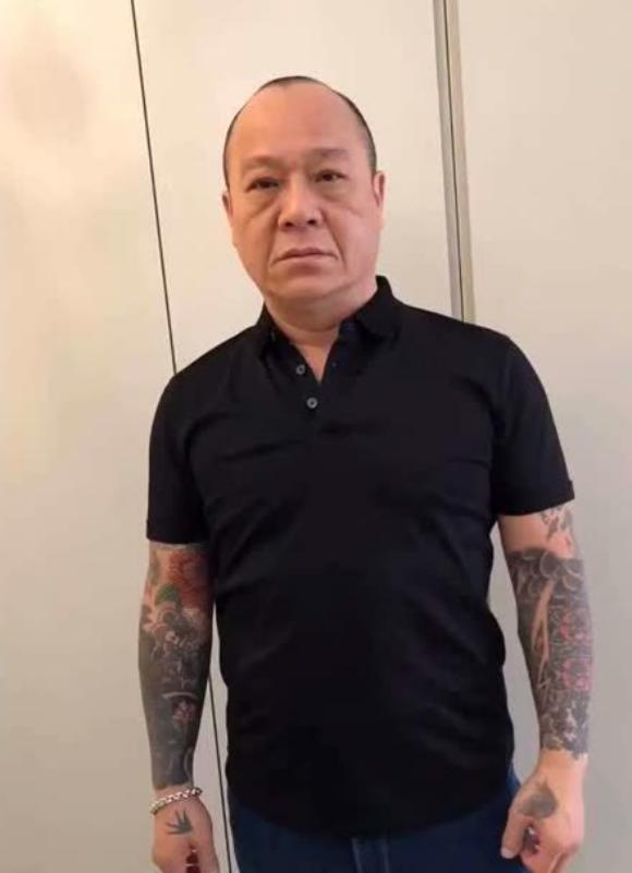 香港知名男星被砍留后遗症，脸皮险被砍掉，身上多处刀疤清晰可见
