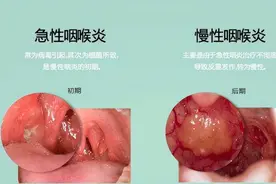 痰多吐不完？一个古方，将嗓子里的痰“挖”干净图片