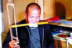 河北硬汉拿不出100万手术费，回家自己锯掉右腿，剧痛中咬碎4颗牙图片
