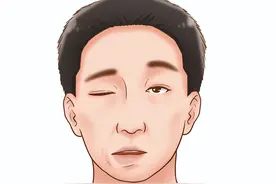 这些常见的食物竟能预防面瘫！春风拂面，四招预防“口眼歪斜”图片