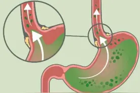 吃饱后，应该坐着、躺着还是站着？提醒：饭后做4件事或会伤身图片