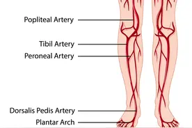懒人有懒福！5个很懒但对静脉健康很好的行为，你一定要记住图片