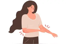 【宽街·明医说】奇痒难忍的“湿疹”，反反复复，怎样做才能好得快？图片