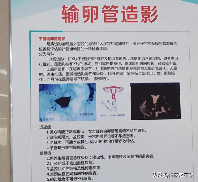 做输卵管造影疼不疼，都需要准备什么？看完你就懂了。