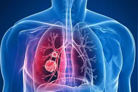 总是半夜3-5点醒？是肺在向你求救！教你清肺养肺，一觉到天亮图片