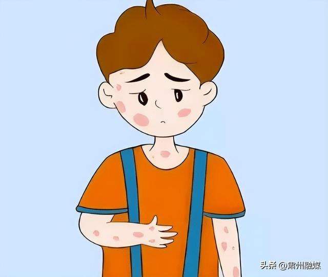 一脱衣服身上很多皮屑脱落，怎么回事？是缺维生素了？涨知识了！