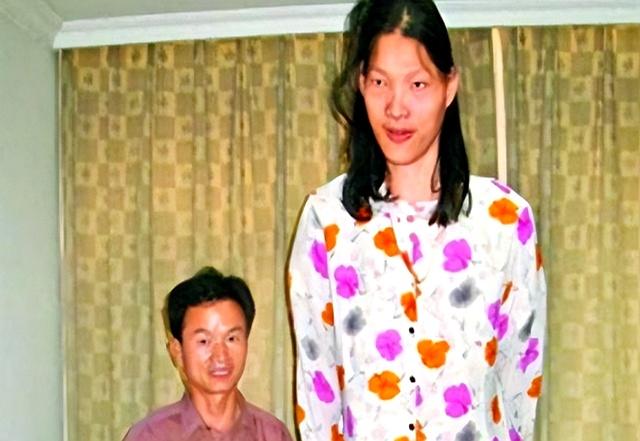 世界第一女巨人来自中国安徽，穿78码的鞋子，一顿饭吃六碗炒面