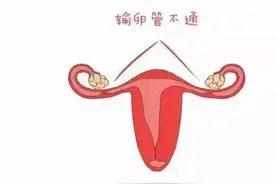 输卵管通而不畅，还能正常怀孕吗？图片
