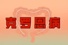 肠道的“隐秘敌人”：克罗恩病！出现症状有哪些？如何治疗与预防图片