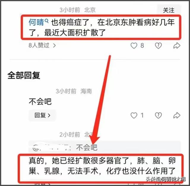 许亚军前妻何晴去世，5月被曝癌症大面积扩散，此前得过脑瘤