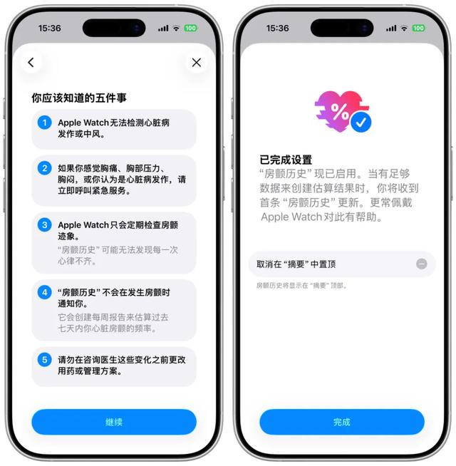 Apple Watch房颤历史功能设置
