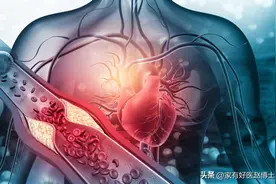 常规体检很难直接发现冠心病！平时有这类症状，应做冠脉CTA/造影图片