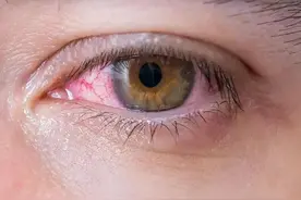 嘴巴干、嘴巴苦，可能是肝胆不好，3个中成药，解决口干口苦图片