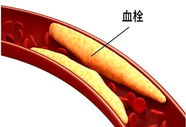 走路才是最有效运动？科学家：每天至少走4967步。尤其是老年人！
