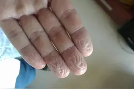 "手指泡水起皱的秘密，一旦理解，瞬间豁然开朗！"图片