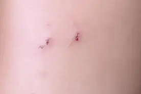 致命危机！毒蛇咬伤后如何‘争分夺秒’自救？图片