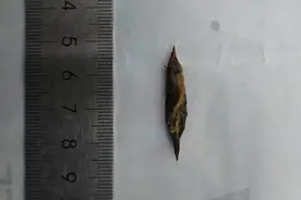 做小儿推拿缓解腹痛，看急诊发现是枣核戳穿肠！图片