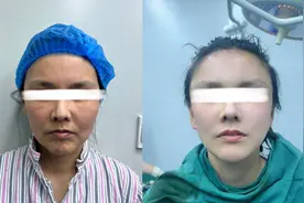 72年出生，今年53岁，医美保养3年经验分享，大家觉得像多少岁？图片