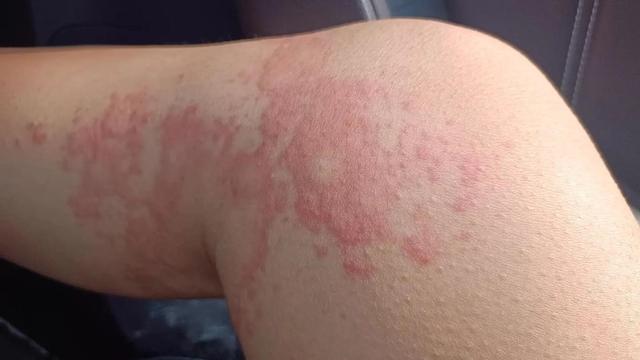 铅含量超标30倍！央视曝光新毒物，致癌率极高，很多人天天拿手里