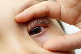 “左眼跳财，右眼跳灾”？女老板左眼一直跳，结果竟是疾病信号图片