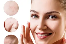 三招淡化法令纹，期待大家三周后的明显变化图片