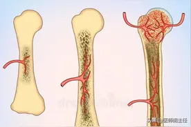 春天猛涨期，让孩子多吃碱性食物图片
