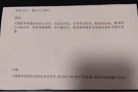 股骨颈骨折5个月后，拍片复查后医生嘱咐：该干什么干什么图片
