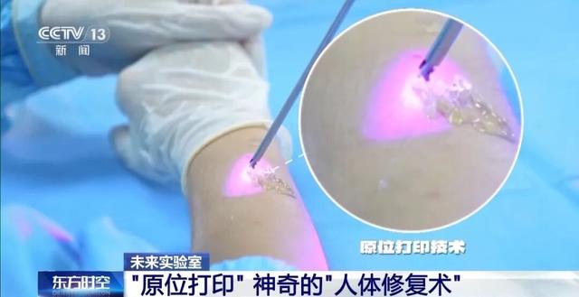 耳朵、骨骼、心脏、喉管……这些类器官能3D打印了！
