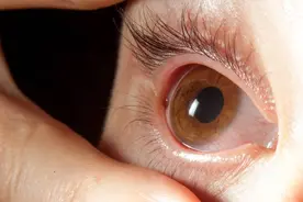 沙子进眼可以用嘴吹吗？图片