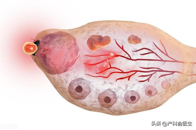 女人的卵巢长什么样子？一篇让你秒懂的科普。