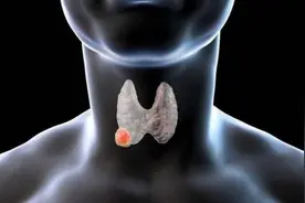 清代一张消瘤方，以麝香化瘀散结，脂肪瘤、囊肿、增生都能用图片