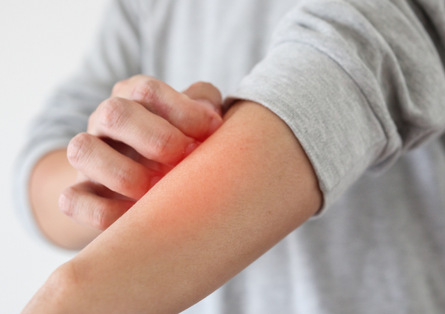 63岁女子皮肤瘙痒	，以为是皮肤病，体检后，医生叹：怎么不早来