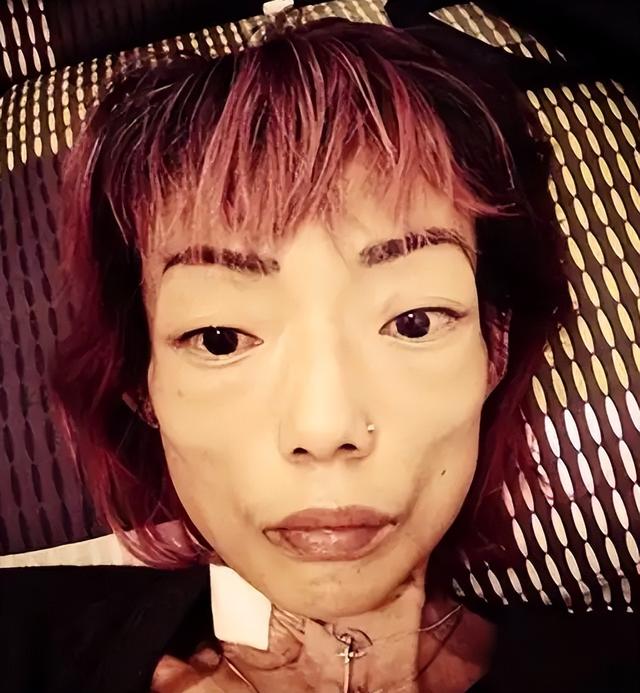 豪门玩物，8年被折磨成牙齿全掉，不足80斤，形似骷髅，惨不忍睹