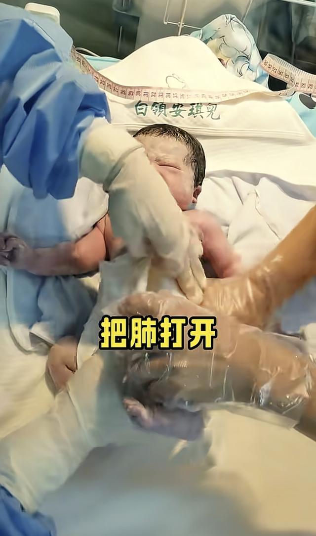 “最惨新生儿”火了，因为太淡定被医生轮番“暴揍”，说好看才哭