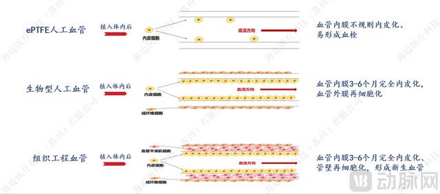 LineMatrix耐迈通®生物型人工血管注册临床试验开启临床入组