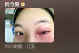 难怪有这么多人莫名得皮肤病！台球室球杆变"脚杆"！看完破防了图片
